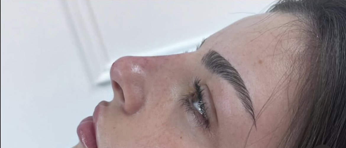 Rhinoplasty after treatment